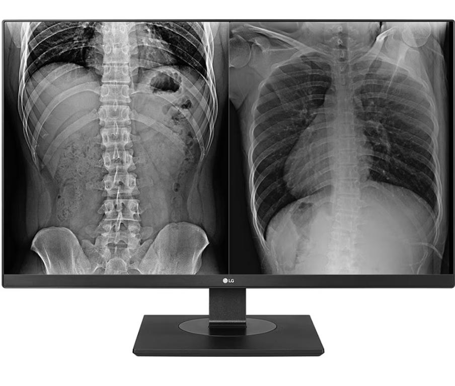 Monitor LED LG Clinical Review 27HJ713C